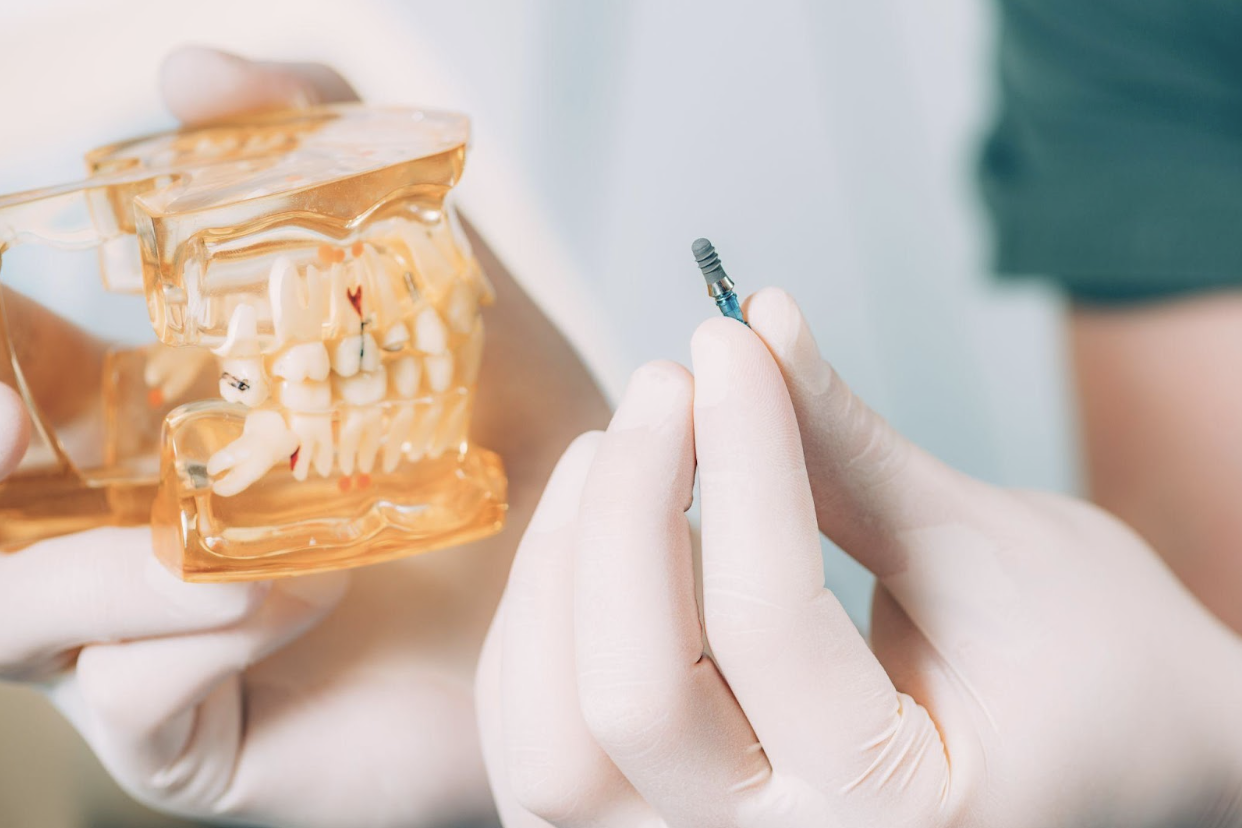 dentist holding a tooth model and dental appliance