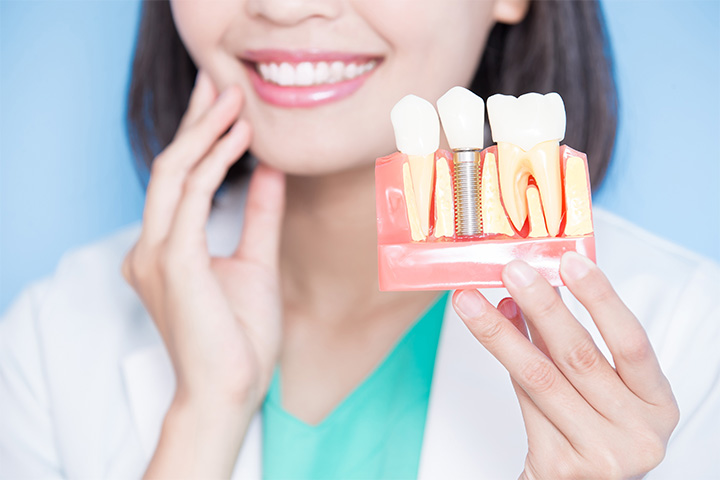 A closeup of a female dentist holding an enlarged dental implant model