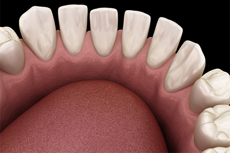 Digital image of gapped teeth.