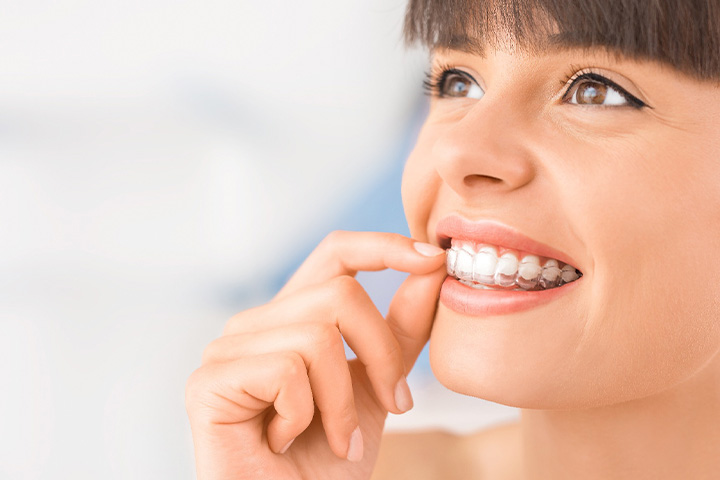 Female patient removing her Invisalign aligner easily.